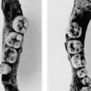 virmuze exhibit Dentition of Individual 1 logo main