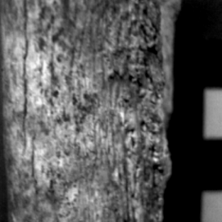 virmuze exhibit Enthesophytosis of the bones of the upper extremities logo main