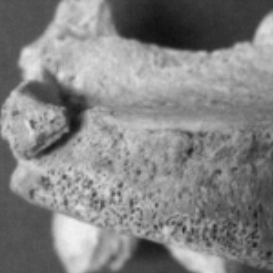 virmuze exhibit Injury remodeling logo main