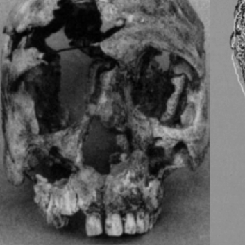 virmuze exhibit Reconstruction of the face of individual 1 logo main