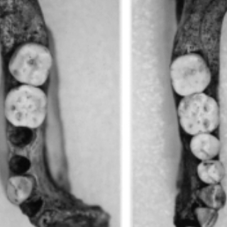 virmuze exhibit Dentition of Individual 2 logo main